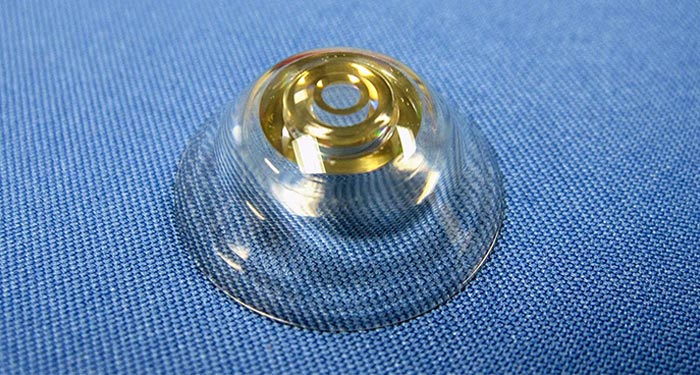 Future Focus: Telescopic Contact Lenses